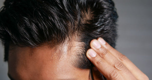 Black Seed Oil Gummies For Hair Health